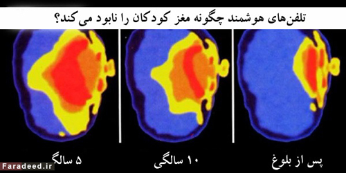 تبلت با مغز کودک شما چه می‌کند؟ (+عکس)