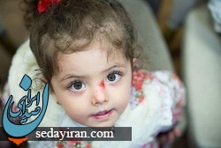 توضیحات رییس اتحادیه تجهیزات پزشکی در رابطه با فوت کودکان مبتلا به بیماری پروانه‌ای
