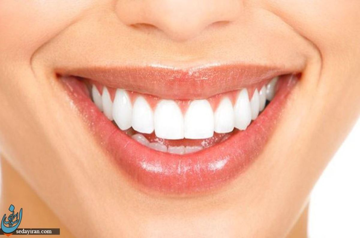 کاشت دندان توسط متخصص ایمپلنت