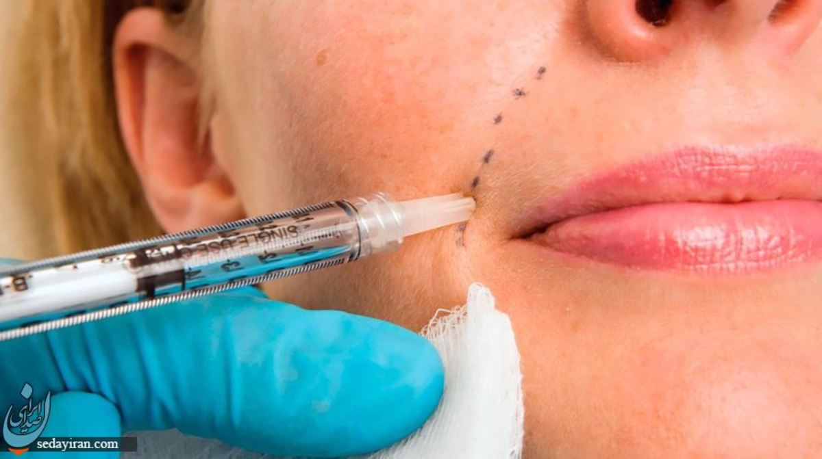 مقایسه استفاده از تزریق ژل و چربی در اصلاح فرم صورت