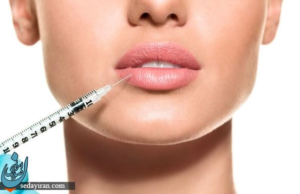  چگونه بهترین مارک ژل لب را پیدا کنیم؟