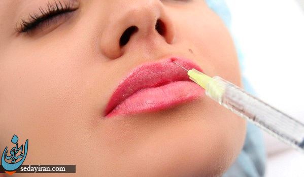  چگونه بهترین مارک ژل لب را پیدا کنیم؟