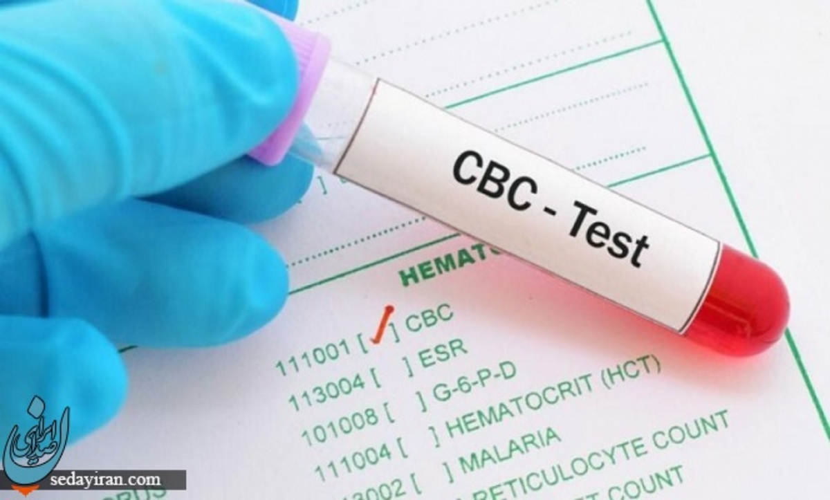 آزمایش CBC در آزمایش خون چیست؟