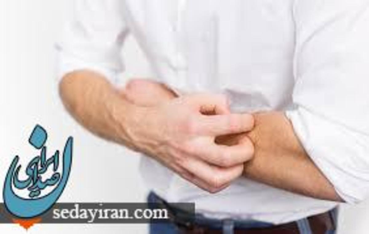 علت خارش بدن چیست؟