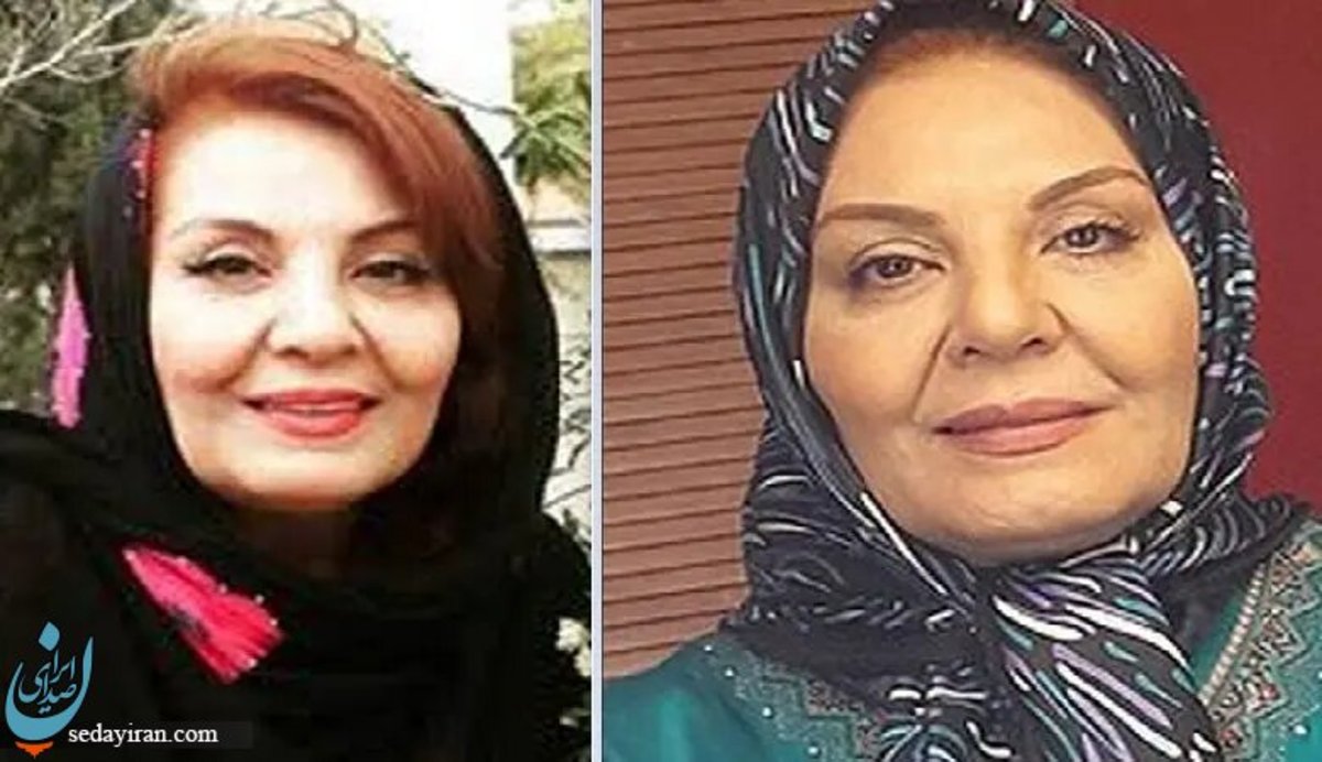 زهره حمیدی به سرطان مبتلا شد عکس