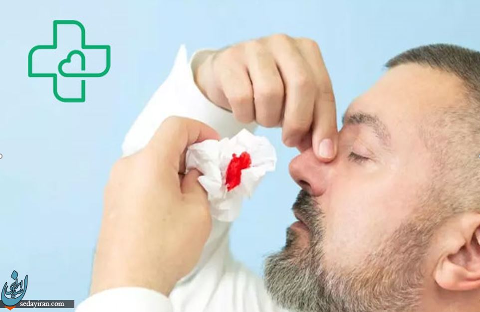 خون ریزی بی دلیل از بینی را کاملا جدی بگیریم!