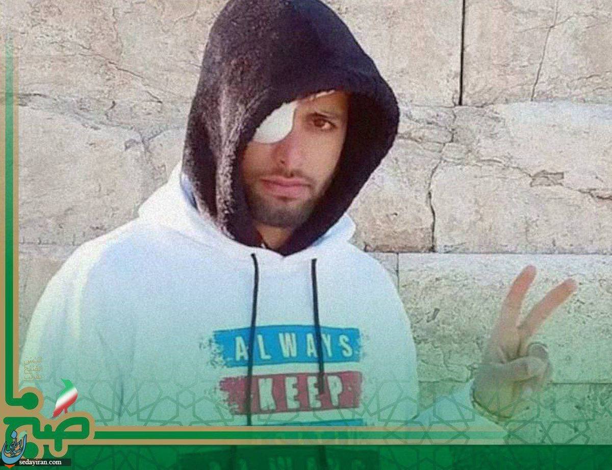 یکی از آسیب دیدگان چشمی اعتراضات به علت عمل نکردن چشمانش خودکشی کرد / عکس