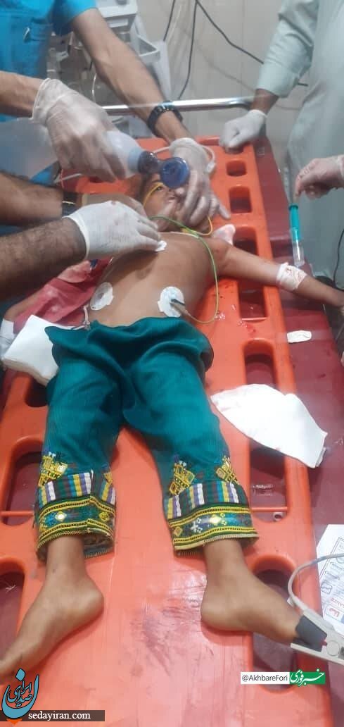 عکسی تلخ از کودک مجروح شده در حمله تروریستی راسک و چابهار عکسی تلخ از کودک مجروح شده در حمله تروریستی راسک و چابهار