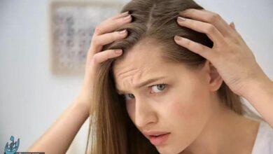 جدیدترین و موثرترین روش‌های کاشت مو برای خانم‌ها