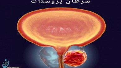 پروستات: غده‌ای کوچک با نقشی بزرگ در سلامت مردان