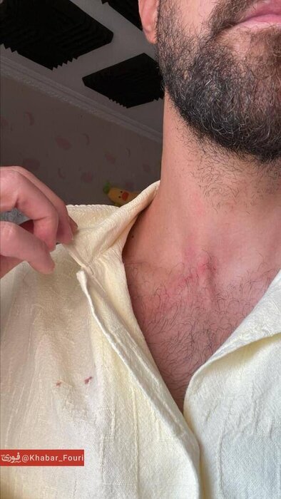 جزئیات حمله به بازیکن سابق استقلال (+عکس)