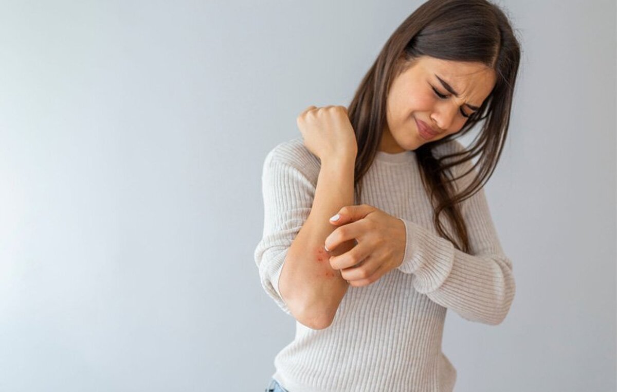 علت خارش بدن چیست؟