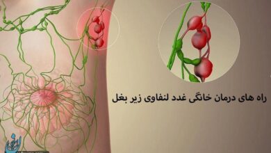 راه های درمان خانگی غدد لنفاوی زیر بغل