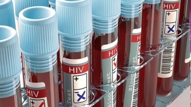 65 درصد مبتلایان ایرانی به بیماری HIV از طریق تماس جنسی!