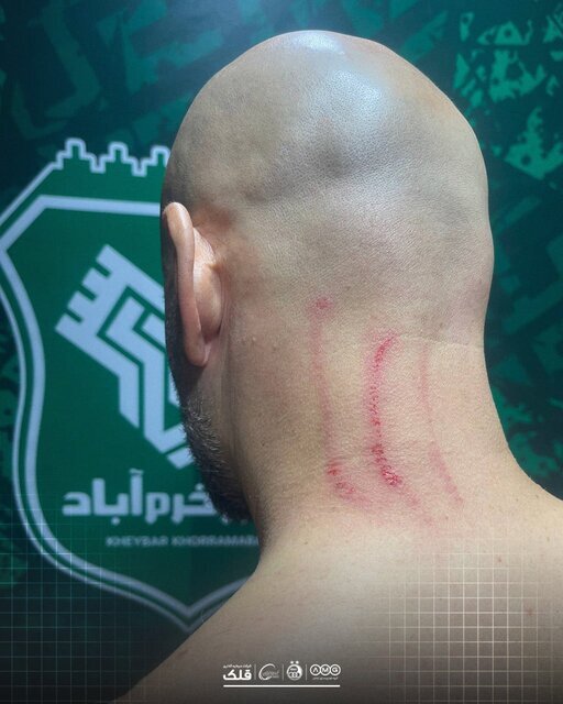 واکنش باشگاه‌های استقلال و خیبر به اتفاقات بازی امروز